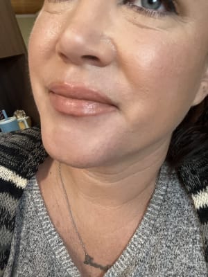 View Gallery Image #1