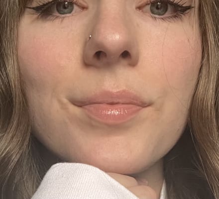 View Gallery Image #1