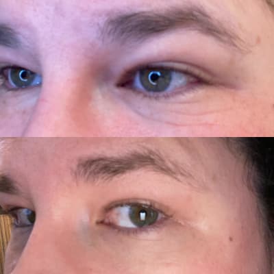 Lotus Youth Preserve Depuffing Eye Cream