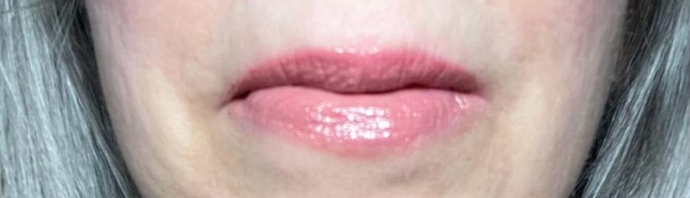 View Gallery Image #1
