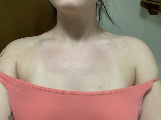 View Gallery Image #1