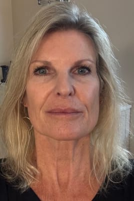 View Gallery Image #1