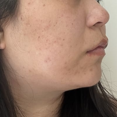 View Gallery Image #1