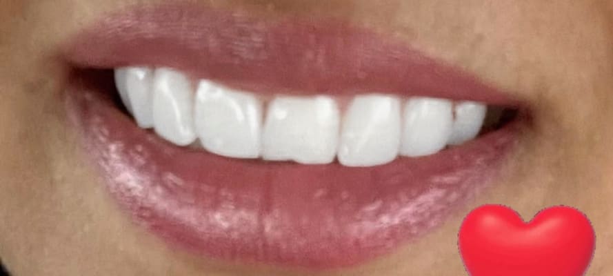 View Gallery Image #1