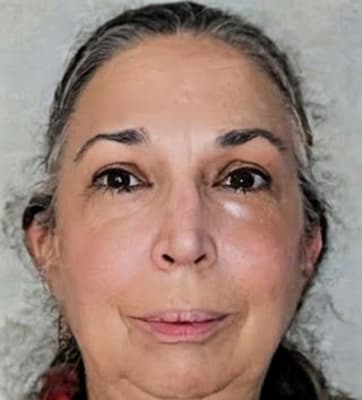 View Gallery Image #2