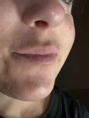 View Gallery Image #1