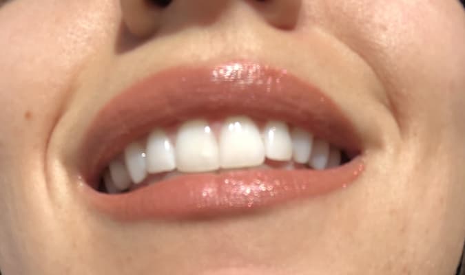 View Gallery Image #5