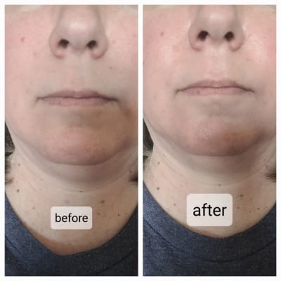 View Gallery Image #12