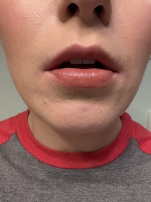 View Gallery Image #1