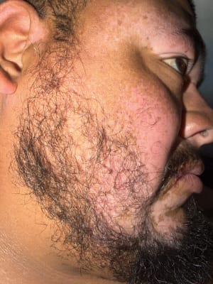 View Gallery Image #1