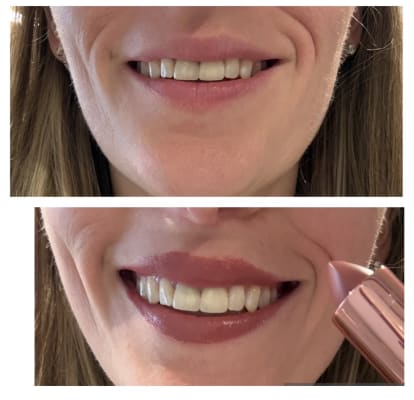 View Gallery Image #2