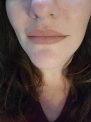 View Gallery Image #5