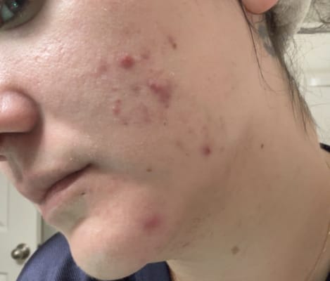 View Gallery Image #1