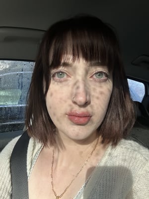 View Gallery Image #1