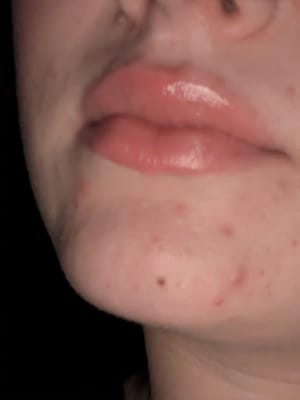 View Gallery Image #1