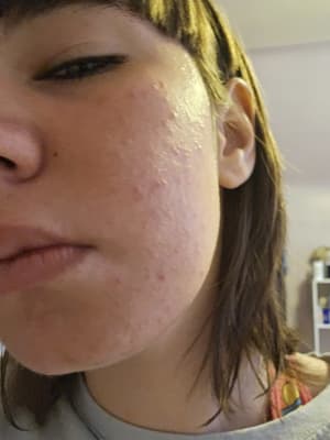 View Gallery Image #1