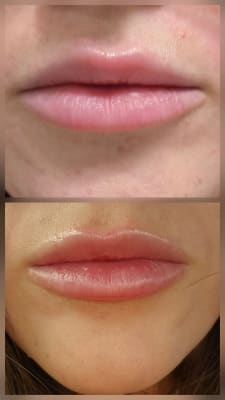 View Gallery Image #2