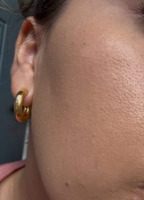 View Gallery Image #1