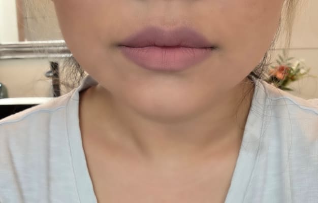 View Gallery Image #7