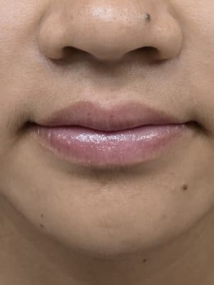 View Gallery Image #5