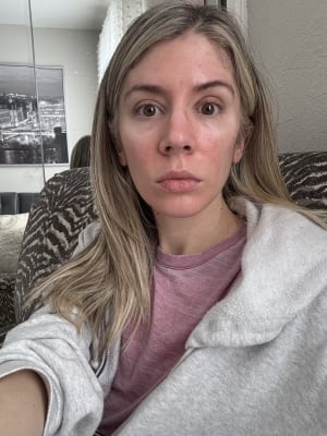 View Gallery Image #1