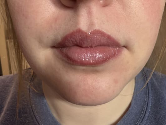 View Gallery Image #15