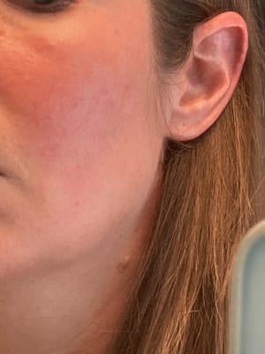 View Gallery Image #1