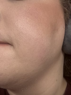 View Gallery Image #1