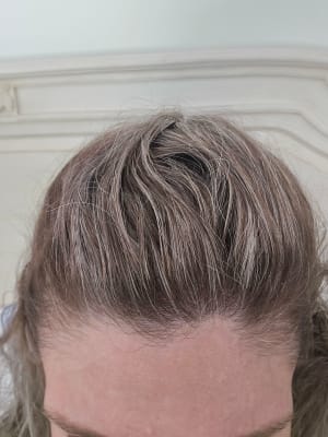 View Gallery Image #1