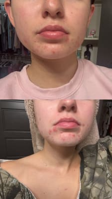 View Gallery Image #1