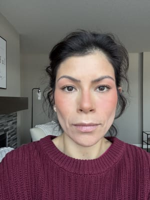 View Gallery Image #1