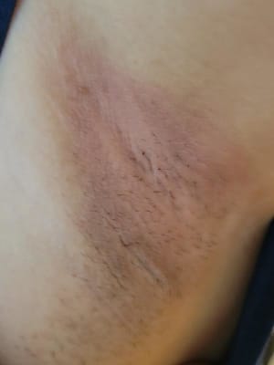 View Gallery Image #1