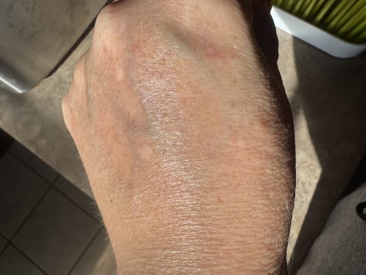 View Gallery Image #1