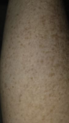 View Gallery Image #1