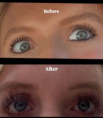 View Gallery Image #1