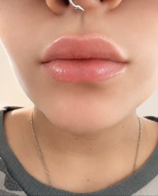 View Gallery Image #1