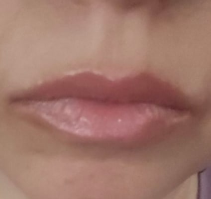 View Gallery Image #1