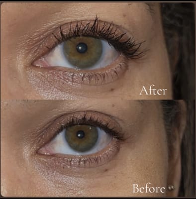 View Gallery Image #1