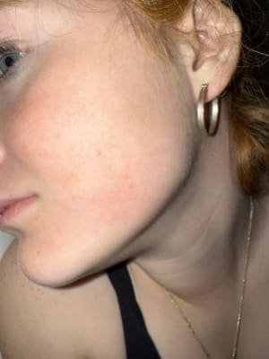 View Gallery Image #1