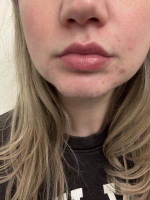 View Gallery Image #5