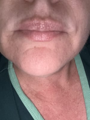 View Gallery Image #1