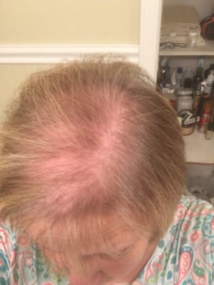 View Gallery Image #1