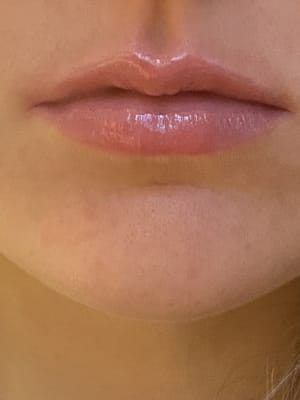 View Gallery Image #1