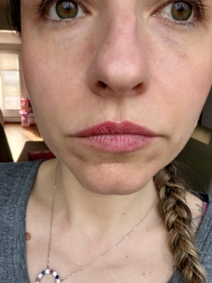 View Gallery Image #1