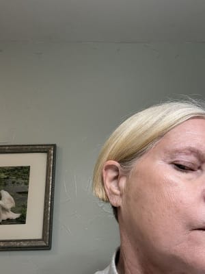 View Gallery Image #1