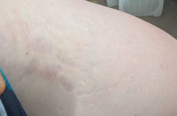 View Gallery Image #2