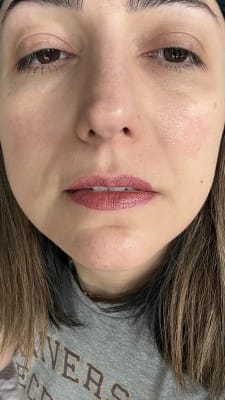 View Gallery Image #1