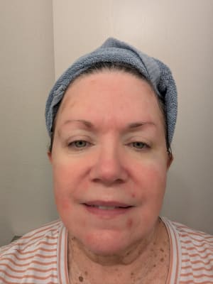 View Gallery Image #1