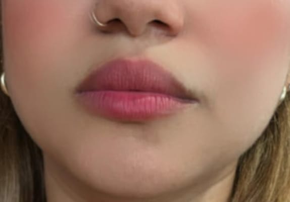 View Gallery Image #1