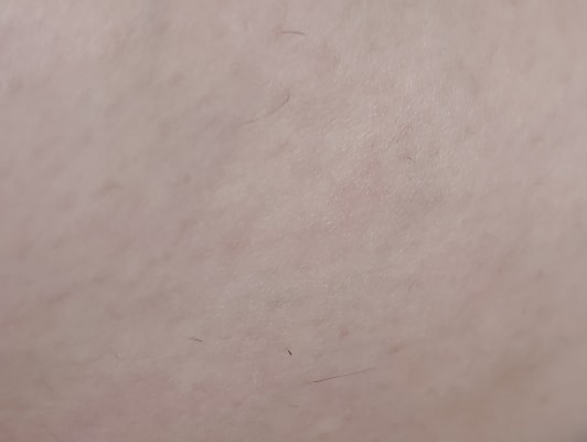 View Gallery Image #1